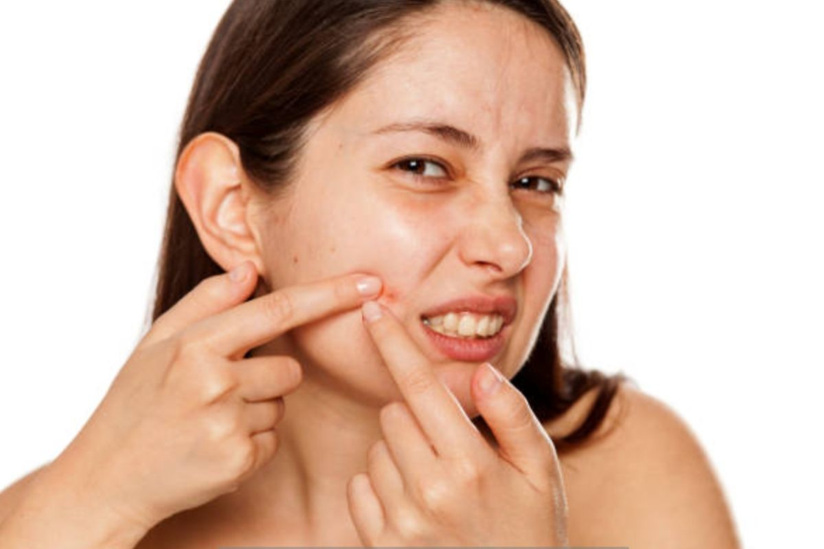 Hilangkan Bekas Jerawat Bopeng? Rahasia Dokter Terungkap!