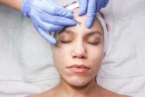 Rahasia Kulit Bebas Jerawat? Kunjungi Klinik Kecantikan Sekarang!