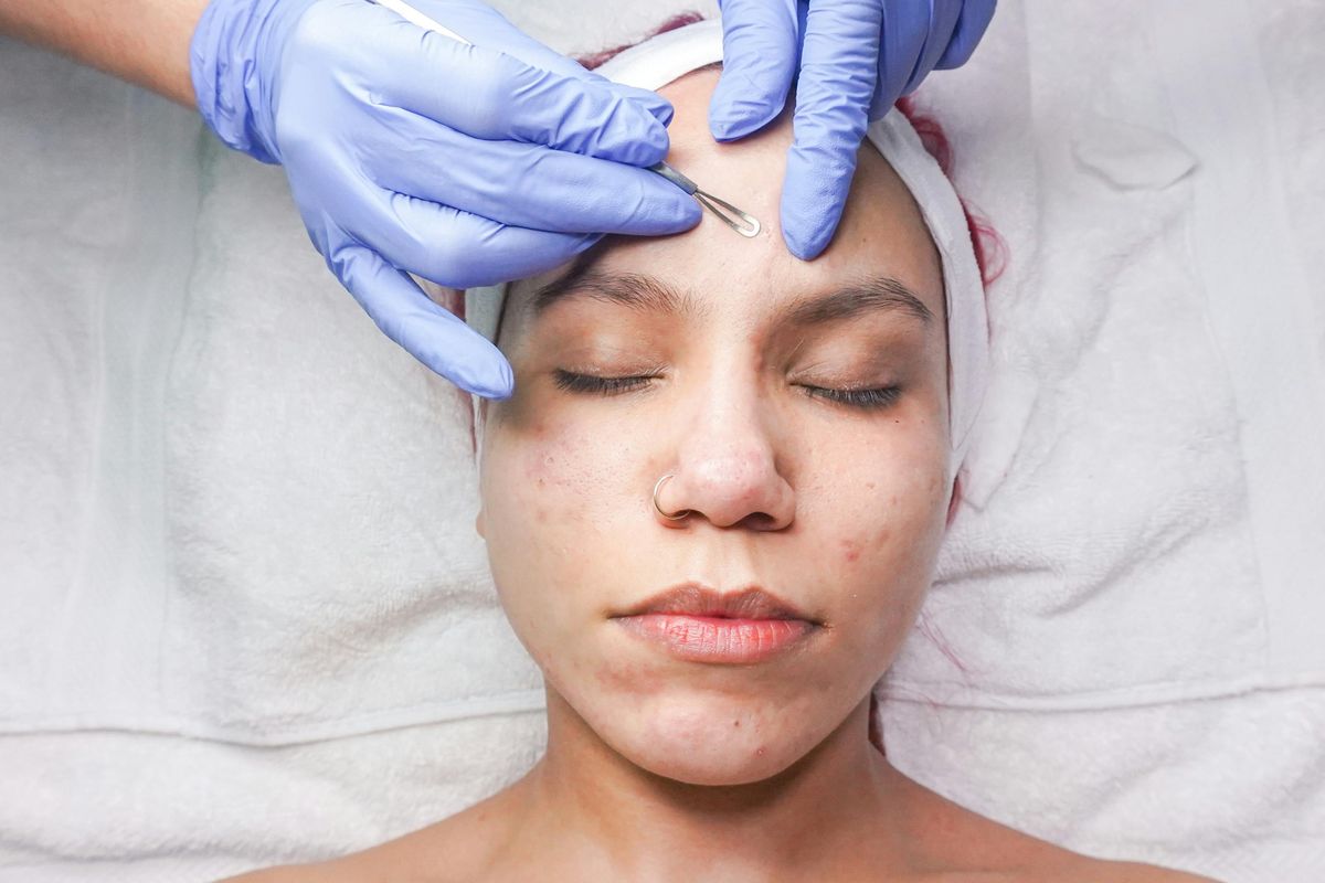 Rahasia Kulit Bebas Jerawat? Kunjungi Klinik Kecantikan Sekarang!