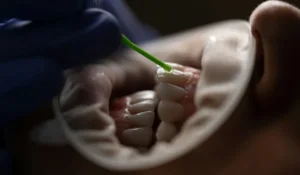 Tambal Gigi BPJS Kesehatan? Cek Info Terbaru & Biaya!